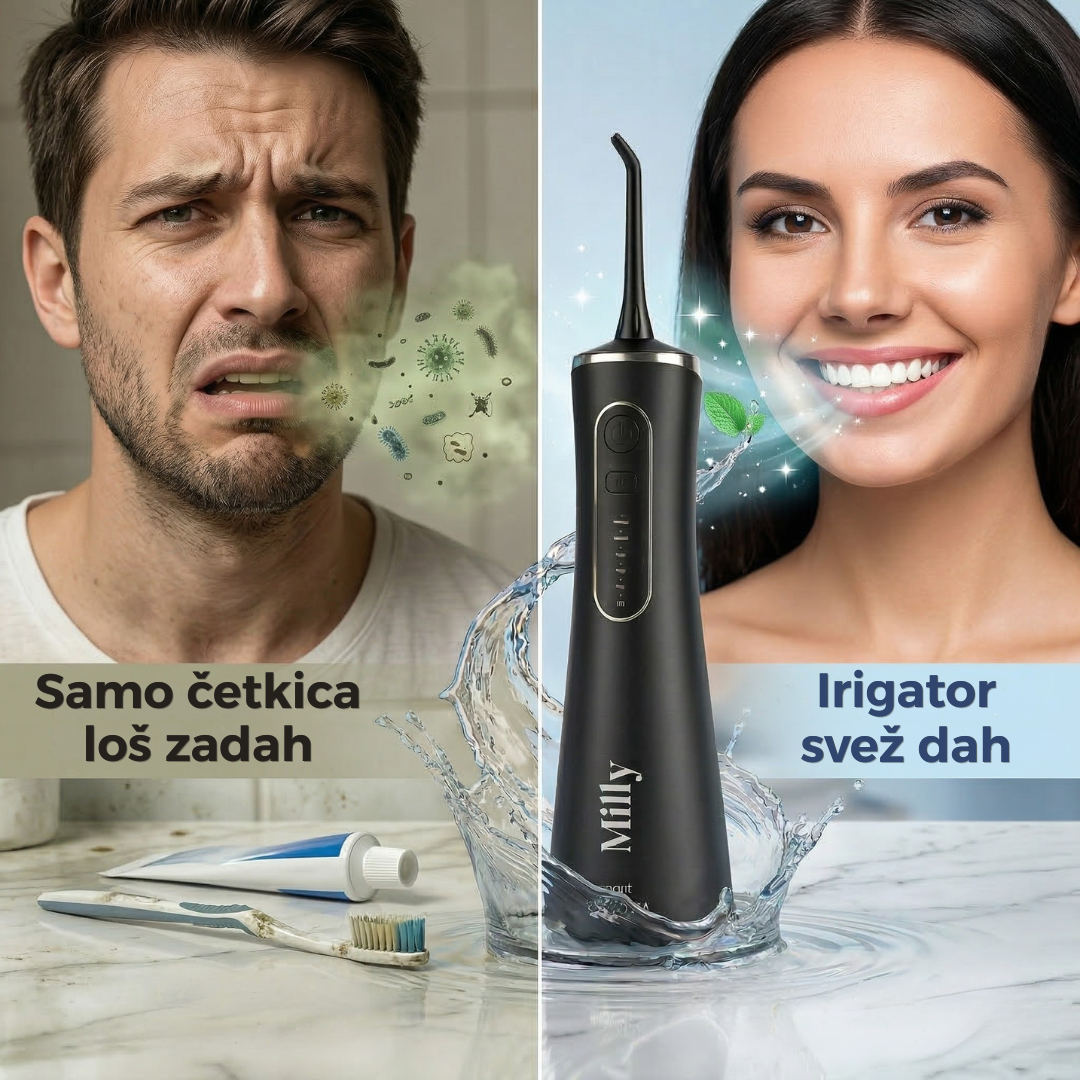 Milly irigator za zube | 1+1 GRATIS